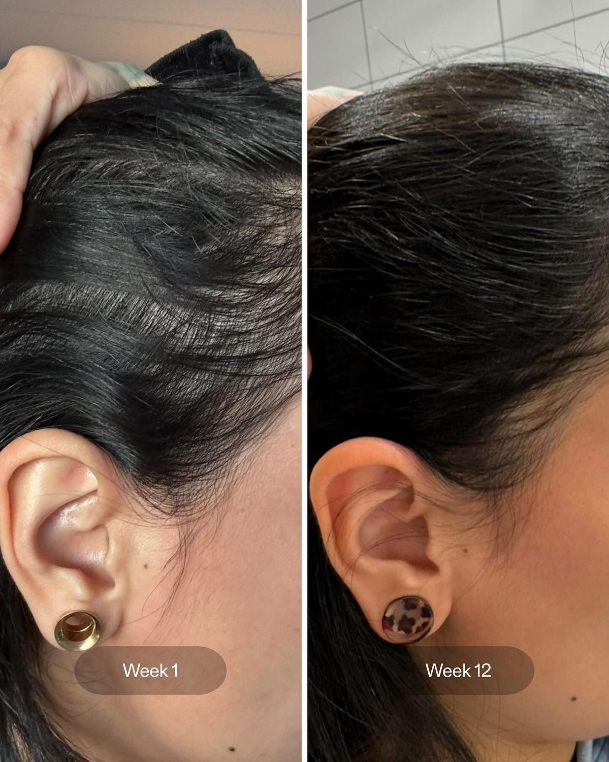 Brosse Massante Autonome 3-en-1